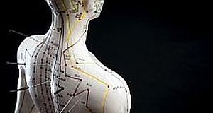 New UK guidance: Acupuncture rather than drugs for chronic pain