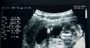 Cash incentives for GPs led to sharp fall in abortion rates