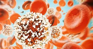 A month's delay in cancer treatment may raise death risk up to 13%