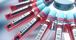 UK to trial blood test that detects more than 50 types of cancer