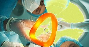 Metabolic surgery versus conventional therapy for type 2 diabetes — 10-year trial