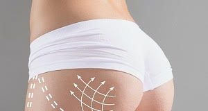 Brazilian butt lift: Behind the world's most dangerous cosmetic surgery