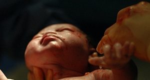 Pandemic linked to substantially worse pregnancy outcomes worldwide