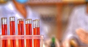 NHS pilots simple blood test that screens for 50 types of cancer