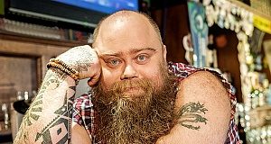 Overweight substantially worsens liver-damaging effects of excessive alcohol use