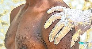 Scaling up COVID-19 vaccination in Africa: lessons from the HIV pandemic