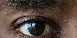 Tanzanian study: Laser more effective treatment than daily eye drops
