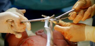 A 60 second delay in cord-clamping cuts relative mortality by 30%