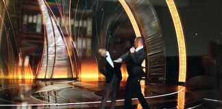 BRAVE trials show that baricitinib can slap down alopecia