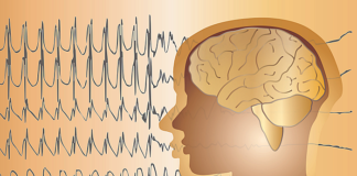 People with epilepsy live 10-12-years shorter lives – Danish cohort study