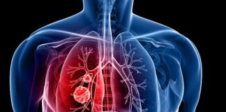 US study suggests why most smokers do not get lung cancer