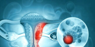 Cancer screening – the good, the bad and the ugly