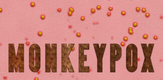 Scientists warn of more zoonotic diseases as third SA monkeypox case confirmed