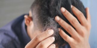 One single chemical could be cure for baldness – US study
