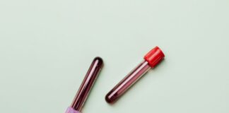 Common kidney blood test unsuitable for diagnoses in Africans – large cohort study