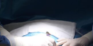 Steady decline in survival of pancreatitis surgery patients – US study