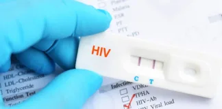SA’s HIV testing formula to change