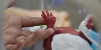 Call for more action as one premature baby born every two seconds globally