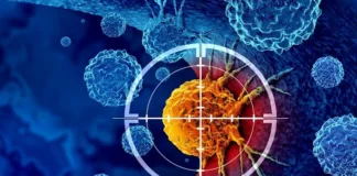 The retreat of radiation, mainstay of cancer treatment