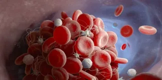 Blood clot risk rises with Pill/painkiller combo – Danish study
