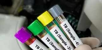 Clinical trial reveals 'breakthrough' treatment options for MDR-TB