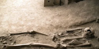 MS origins traced to surprising DNA link to ancient Europeans