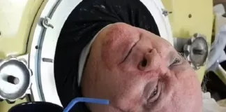 US man dies after living in iron lung for 70 years