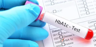 Diabetes a leading killer in SA, but we don't know how many have it