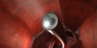 How old is too old for colonoscopy?