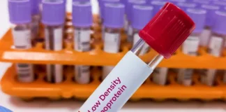 SA heart groups urge stricter testing to prevent ASCVD