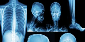 Will AI replace radiologists, or make them even better?