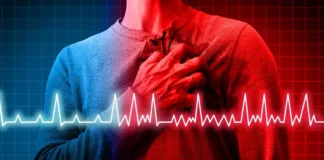 Atrial fibrillation tied to higher risk of stroke and dementia