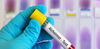 Alzheimer’s blood test scores 90% accuracy in Swedish study