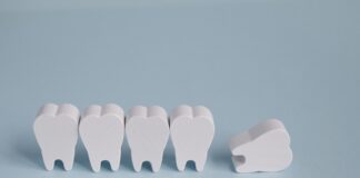 Severe tooth loss linked to higher risk of fatal heart disease – US analysis
