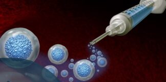 World first as woman’s own stem cells reverse her diabetes