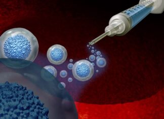 World first as woman’s own stem cells reverse her diabetes